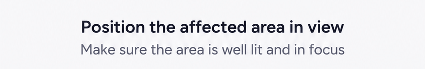 Position the affected area in view